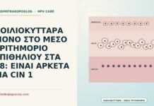 ΚΟΙΛΙΟΚΥΤΤΑΡΑ ΜΟΝΟ ΣΤΟ ΜΕΣΟ ΤΡΙΤΗΜΟΡΙΟ ΕΠΙΘΗΛΙΟΥ ΣΤΑ 28: ΕΙΝΑΙ ΑΡΚΕΤΑ ΓΙΑ CIN 1 κοιλιοκύτταρα στο μέσο τριτημόριο
