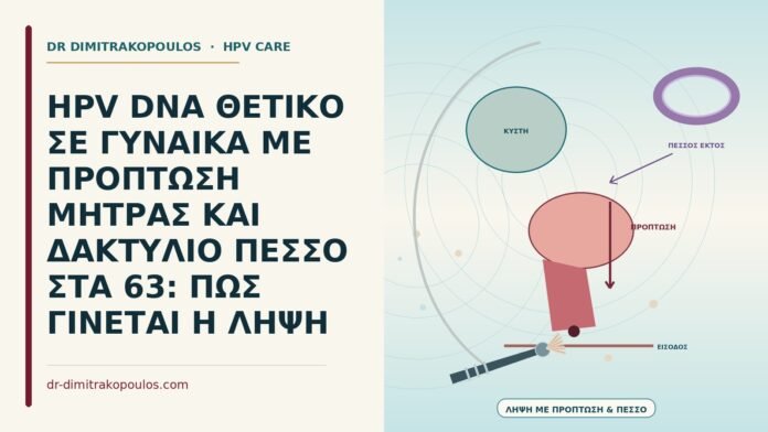HPV DNA ΘΕΤΙΚΟ ΣΕ ΓΥΝΑΙΚΑ ΜΕ ΠΡΟΠΤΩΣΗ ΜΗΤΡΑΣ ΚΑΙ ΔΑΚΤΥΛΙΟ ΠΕΣΣΟ ΣΤΑ 63: ΠΩΣ ΓΙΝΕΤΑΙ Η ΛΗΨΗ πεσσός για πρόπτωση μήτρας