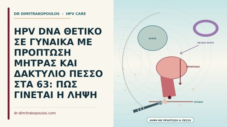 πεσσός για πρόπτωση μήτρας
