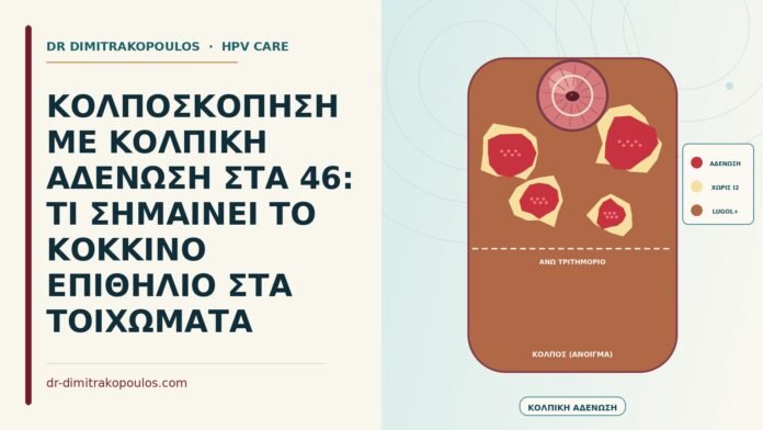 κολπική αδένωση