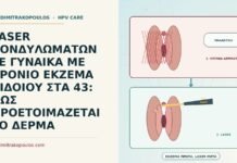 laser με έκζεμα αιδοίου