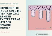επέκταση CIN 3 σε αδενικές κρύπτες