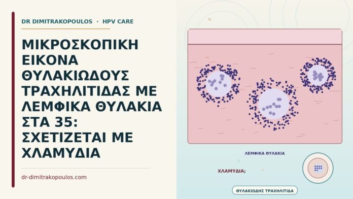 ΜΙΚΡΟΣΚΟΠΙΚΗ ΕΙΚΟΝΑ ΘΥΛΑΚΙΩΔΟΥΣ ΤΡΑΧΗΛΙΤΙΔΑΣ ΜΕ ΛΕΜΦΙΚΑ ΘΥΛΑΚΙΑ ΣΤΑ 35: ΣΧΕΤΙΖΕΤΑΙ ΜΕ ΧΛΑΜΥΔΙΑ θυλακιώδης τραχηλίτιδα