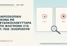 ψευδοκοιλοκύτταρα από φλεγμονή