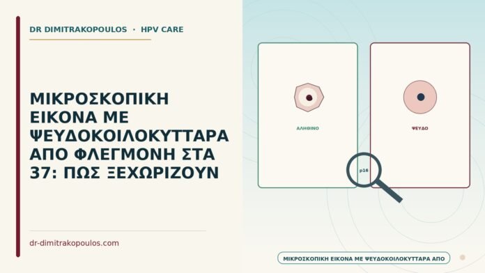 ΜΙΚΡΟΣΚΟΠΙΚΗ ΕΙΚΟΝΑ ΜΕ ΨΕΥΔΟΚΟΙΛΟΚΥΤΤΑΡΑ ΑΠΟ ΦΛΕΓΜΟΝΗ ΣΤΑ 37: ΠΩΣ ΞΕΧΩΡΙΖΟΥΝ ψευδοκοιλοκύτταρα από φλεγμονή
