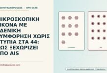 αδενική συμφόρηση χωρίς ατυπία