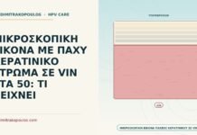 ΜΙΚΡΟΣΚΟΠΙΚΗ ΕΙΚΟΝΑ ΜΕ ΠΑΧΥ ΚΕΡΑΤΙΝΙΚΟ ΣΤΡΩΜΑ ΣΕ VIN ΣΤΑ 50: ΤΙ ΔΕΙΧΝΕΙ παχύ κερατινικό στρώμα σε VIN
