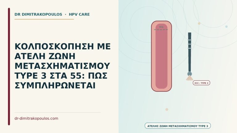 ατελής ζώνη μετασχηματισμού type 3