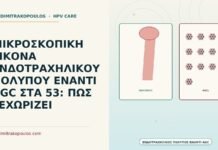 ενδοτραχηλικός πολύποδας έναντι AGC