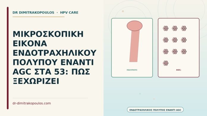 ΜΙΚΡΟΣΚΟΠΙΚΗ ΕΙΚΟΝΑ ΕΝΔΟΤΡΑΧΗΛΙΚΟΥ ΠΟΛΥΠΟΥ ΕΝΑΝΤΙ AGC ΣΤΑ 53: ΠΩΣ ΞΕΧΩΡΙΖΕΙ ενδοτραχηλικός πολύποδας έναντι AGC