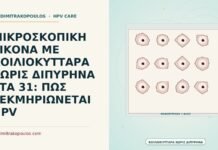 ΜΙΚΡΟΣΚΟΠΙΚΗ ΕΙΚΟΝΑ ΜΕ ΚΟΙΛΙΟΚΥΤΤΑΡΑ ΧΩΡΙΣ ΔΙΠΥΡΗΝΑ ΣΤΑ 31: ΠΩΣ ΤΕΚΜΗΡΙΩΝΕΤΑΙ HPV κοιλιοκύτταρα χωρίς διπύρηνα