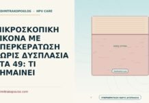 ΜΙΚΡΟΣΚΟΠΙΚΗ ΕΙΚΟΝΑ ΜΕ ΥΠΕΡΚΕΡΑΤΩΣΗ ΧΩΡΙΣ ΔΥΣΠΛΑΣΙΑ ΣΤΑ 49: ΤΙ ΣΗΜΑΙΝΕΙ υπερκεράτωση χωρίς δυσπλασία