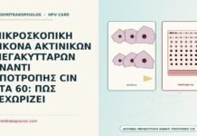 ΜΙΚΡΟΣΚΟΠΙΚΗ ΕΙΚΟΝΑ ΑΚΤΙΝΙΚΩΝ ΜΕΓΑΚΥΤΤΑΡΩΝ ΕΝΑΝΤΙ ΥΠΟΤΡΟΠΗΣ CIN ΣΤΑ 60: ΠΩΣ ΞΕΧΩΡΙΖΕΙ μικροσκοπική εικόνα ακτινικών μεγακυττάρων έναντι υποτροπής CIN