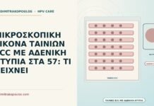 ΜΙΚΡΟΣΚΟΠΙΚΗ ΕΙΚΟΝΑ ΤΑΙΝΙΩΝ ECC ΜΕ ΑΔΕΝΙΚΗ ΑΤΥΠΙΑ ΣΤΑ 57: ΤΙ ΔΕΙΧΝΕΙ μικροσκοπική εικόνα ταινιών ECC με αδενική ατυπία