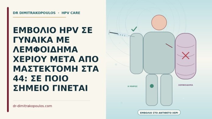 ΕΜΒΟΛΙΟ HPV ΣΕ ΓΥΝΑΙΚΑ ΜΕ ΛΕΜΦΟΙΔΗΜΑ ΧΕΡΙΟΥ ΜΕΤΑ ΑΠΟ ΜΑΣΤΕΚΤΟΜΗ ΣΤΑ 44: ΣΕ ΠΟΙΟ ΣΗΜΕΙΟ ΓΙΝΕΤΑΙ εμβόλιο HPV με λεμφοίδημα χεριού