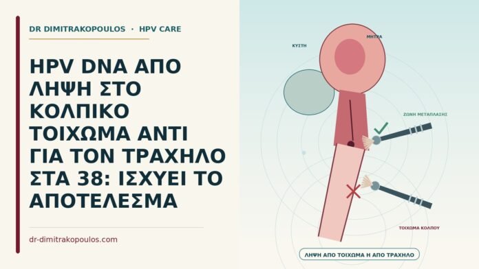HPV DNA ΑΠΟ ΛΗΨΗ ΣΤΟ ΚΟΛΠΙΚΟ ΤΟΙΧΩΜΑ ΑΝΤΙ ΓΙΑ ΤΟΝ ΤΡΑΧΗΛΟ ΣΤΑ 38: ΙΣΧΥΕΙ ΤΟ ΑΠΟΤΕΛΕΣΜΑ HPV DNA από λήψη στο κολπικό τοίχωμα