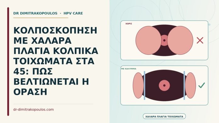 ΚΟΛΠΟΣΚΟΠΗΣΗ ΜΕ ΧΑΛΑΡΑ ΠΛΑΓΙΑ ΚΟΛΠΙΚΑ ΤΟΙΧΩΜΑΤΑ ΣΤΑ 45: ΠΩΣ ΒΕΛΤΙΩΝΕΤΑΙ Η ΟΡΑΣΗ κολποσκόπηση με χαλαρά πλάγια κολπικά τοιχώματα