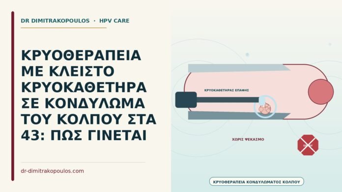 ΚΡΥΟΘΕΡΑΠΕΙΑ ΜΕ ΚΛΕΙΣΤΟ ΚΡΥΟΚΑΘΕΤΗΡΑ ΣΕ ΚΟΝΔΥΛΩΜΑ ΤΟΥ ΚΟΛΠΟΥ ΣΤΑ 43: ΠΩΣ ΓΙΝΕΤΑΙ κρυοθεραπεία με κλειστό κρυοκαθετήρα στον κόλπο