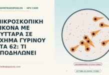 ΜΙΚΡΟΣΚΟΠΙΚΗ ΕΙΚΟΝΑ ΜΕ ΚΥΤΤΑΡΑ ΣΕ ΣΧΗΜΑ ΓΥΡΙΝΟΥ ΣΤΑ 62: ΤΙ ΥΠΟΔΗΛΩΝΕΙ μικροσκοπική εικόνα με κύτταρα σε σχήμα γυρίνου