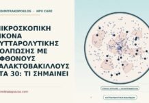 μικροσκοπική εικόνα κυτταρολυτικής κόλπωσης