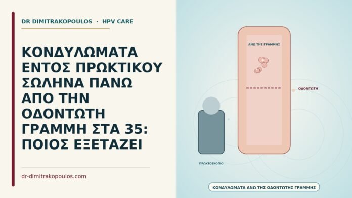 κονδυλώματα πάνω από την οδοντωτή γραμμή
