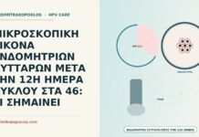 ΜΙΚΡΟΣΚΟΠΙΚΗ ΕΙΚΟΝΑ ΕΝΔΟΜΗΤΡΙΩΝ ΚΥΤΤΑΡΩΝ ΜΕΤΑ ΤΗΝ 12Η ΗΜΕΡΑ ΚΥΚΛΟΥ ΣΤΑ 46: ΤΙ ΣΗΜΑΙΝΕΙ μικροσκοπική εικόνα ενδομητρίων κυττάρων