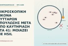 ΜΙΚΡΟΣΚΟΠΙΚΗ ΕΙΚΟΝΑ ΚΥΤΤΑΡΩΝ ΕΠΟΥΛΩΣΗΣ ΜΕΤΑ ΑΠΟ ΚΑΥΤΗΡΙΑΣΗ ΣΤΑ 41: ΜΟΙΑΖΕΙ ΜΕ HSIL μικροσκοπική εικόνα κυττάρων επούλωσης