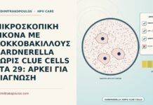ΜΙΚΡΟΣΚΟΠΙΚΗ ΕΙΚΟΝΑ ΜΕ ΚΟΚΚΟΒΑΚΙΛΛΟΥΣ GARDNERELLA ΧΩΡΙΣ CLUE CELLS ΣΤΑ 29: ΑΡΚΕΙ ΓΙΑ ΔΙΑΓΝΩΣΗ μικροσκοπική εικόνα με κοκκοβακίλλους Gardnerella