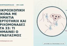 ΜΙΚΡΟΣΚΟΠΙΚΗ ΕΙΚΟΝΑ ΜΕ ΝΗΜΑΤΙΑ LEPTOTHRIX ΚΑΙ ΤΡΙΧΟΜΟΝΑΔΕΣ ΣΤΑ 33: ΤΙ ΣΗΜΑΙΝΕΙ Ο ΣΥΝΔΥΑΣΜΟΣ μικροσκοπική εικόνα με Leptothrix και τριχομονάδες