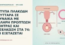 άτυπα πλακώδη κύτταρα με πρόπτωση μήτρας