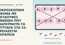 ψευδοϋφές Candida