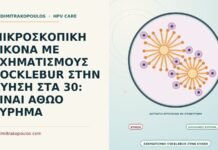 σχηματισμοί cocklebur στην κύηση