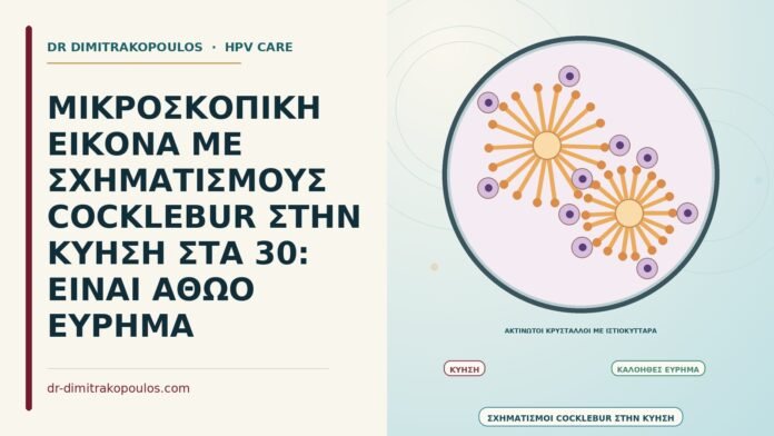 σχηματισμοί cocklebur στην κύηση