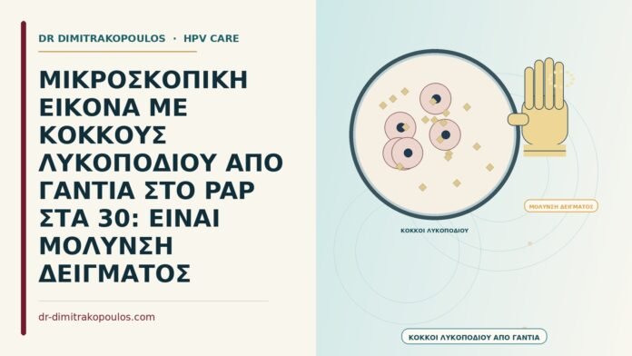 ΜΙΚΡΟΣΚΟΠΙΚΗ ΕΙΚΟΝΑ ΜΕ ΚΟΚΚΟΥΣ ΛΥΚΟΠΟΔΙΟΥ ΑΠΟ ΓΑΝΤΙΑ ΣΤΟ PAP ΣΤΑ 30: ΕΙΝΑΙ ΜΟΛΥΝΣΗ ΔΕΙΓΜΑΤΟΣ κόκκους λυκοποδίου από γάντια στο Παπ