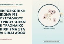 ΜΙΚΡΟΣΚΟΠΙΚΗ ΕΙΚΟΝΑ ΜΕ ΚΡΥΣΤΑΛΛΟΥΣ ΟΥΡΙΚΟΥ ΟΞΕΟΣ ΣΕ ΤΡΑΧΗΛΙΚΟ ΕΠΙΧΡΙΣΜΑ ΣΤΑ 49: ΕΙΝΑΙ ΑΘΩΟ κρυστάλλους ουρικού οξέος σε τραχηλικό επίχρισμα