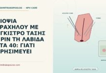 ΒΙΟΨΙΑ ΤΡΑΧΗΛΟΥ ΜΕ ΑΓΚΙΣΤΡΟ ΤΑΣΗΣ ΠΡΙΝ ΤΗ ΛΑΒΙΔΑ ΣΤΑ 40: ΓΙΑΤΙ ΧΡΗΣΙΜΕΥΕΙ βιοψία τραχήλου με άγκιστρο τάσης