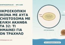 ΜΙΚΡΟΣΚΟΠΙΚΗ ΕΙΚΟΝΑ ΜΕ ΑΥΓΑ SCHISTOSOMA ΜΕ ΤΕΛΙΚΗ ΑΚΑΝΘΑ ΣΤΑ 32: ΤΙ ΣΗΜΑΙΝΕΙ ΓΙΑ ΤΟΝ ΤΡΑΧΗΛΟ αυγά Schistosoma στο επίχρισμα
