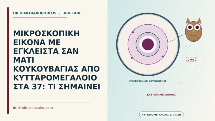ΜΙΚΡΟΣΚΟΠΙΚΗ ΕΙΚΟΝΑ ΜΕ ΕΓΚΛΕΙΣΤΑ ΣΑΝ ΜΑΤΙ ΚΟΥΚΟΥΒΑΓΙΑΣ ΑΠΟ ΚΥΤΤΑΡΟΜΕΓΑΛΟΙΟ ΣΤΑ 37: ΤΙ ΣΗΜΑΙΝΕΙ έγκλειστα κυτταρομεγαλοϊού