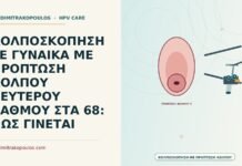 ΚΟΛΠΟΣΚΟΠΗΣΗ ΣΕ ΓΥΝΑΙΚΑ ΜΕ ΠΡΟΠΤΩΣΗ ΚΟΛΠΟΥ ΔΕΥΤΕΡΟΥ ΒΑΘΜΟΥ ΣΤΑ 68: ΠΩΣ ΓΙΝΕΤΑΙ κολποσκόπηση με πρόπτωση κόλπου