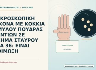 ΜΙΚΡΟΣΚΟΠΙΚΗ ΕΙΚΟΝΑ ΜΕ ΚΟΚΚΙΑ ΑΜΥΛΟΥ ΠΟΥΔΡΑΣ ΓΑΝΤΙΩΝ ΣΕ ΣΧΗΜΑ ΣΤΑΥΡΟΥ ΣΤΑ 36: ΕΙΝΑΙ ΛΟΙΜΩΞΗ κόκκια αμύλου πούδρας γαντιών σε σχήμα σταυρού