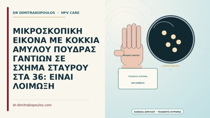 ΜΙΚΡΟΣΚΟΠΙΚΗ ΕΙΚΟΝΑ ΜΕ ΚΟΚΚΙΑ ΑΜΥΛΟΥ ΠΟΥΔΡΑΣ ΓΑΝΤΙΩΝ ΣΕ ΣΧΗΜΑ ΣΤΑΥΡΟΥ ΣΤΑ 36: ΕΙΝΑΙ ΛΟΙΜΩΞΗ κόκκια αμύλου πούδρας γαντιών σε σχήμα σταυρού