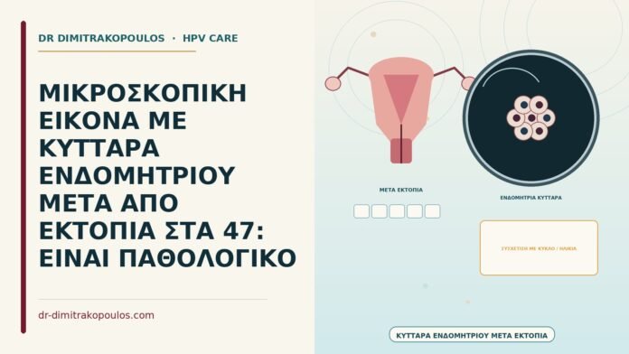 ΜΙΚΡΟΣΚΟΠΙΚΗ ΕΙΚΟΝΑ ΜΕ ΚΥΤΤΑΡΑ ΕΝΔΟΜΗΤΡΙΟΥ ΜΕΤΑ ΑΠΟ ΕΚΤΟΠΙΑ ΣΤΑ 47: ΕΙΝΑΙ ΠΑΘΟΛΟΓΙΚΟ κύτταρα ενδομητρίου μετά από εκτοπία