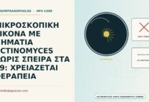 νημάτια Actinomyces χωρίς σπείρα