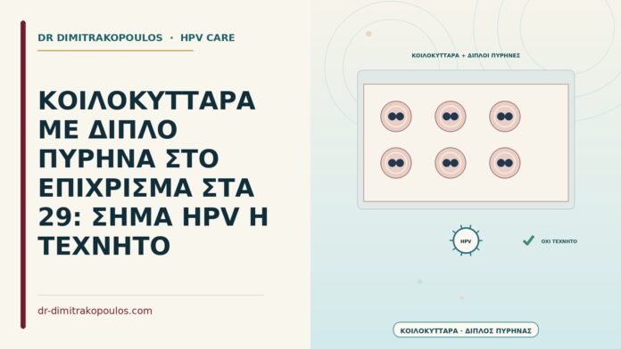 ΚΟΙΛΟΚΥΤΤΑΡΑ ΜΕ ΔΙΠΛΟ ΠΥΡΗΝΑ ΣΤΟ ΕΠΙΧΡΙΣΜΑ ΣΤΑ 29: ΣΗΜΑ HPV Η ΤΕΧΝΗΤΟ κοιλόκυτταρα με διπλό πυρήνα στο επίχρισμα