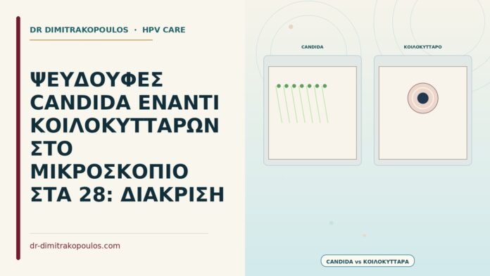 ψευδουφές Candida έναντι κοιλοκυττάρων στο μικροσκόπιο