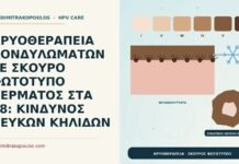 ΚΡΥΟΘΕΡΑΠΕΙΑ ΚΟΝΔΥΛΩΜΑΤΩΝ ΣΕ ΣΚΟΥΡΟ ΦΩΤΟΤΥΠΟ ΔΕΡΜΑΤΟΣ ΣΤΑ 28: ΚΙΝΔΥΝΟΣ ΛΕΥΚΩΝ ΚΗΛΙΔΩΝ κρυοθεραπεία σε σκούρο φωτότυπο