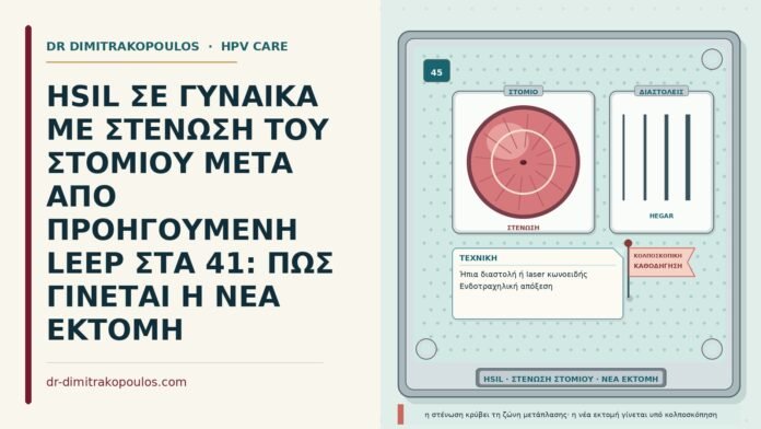 HSIL ΣΕ ΓΥΝΑΙΚΑ ΜΕ ΣΤΕΝΩΣΗ ΤΟΥ ΣΤΟΜΙΟΥ ΜΕΤΑ ΑΠΟ ΠΡΟΗΓΟΥΜΕΝΗ LEEP ΣΤΑ 41: ΠΩΣ ΓΙΝΕΤΑΙ Η ΝΕΑ ΕΚΤΟΜΗ HSIL με στένωση στομίου