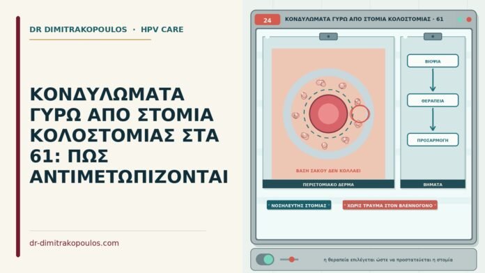 ΚΟΝΔΥΛΩΜΑΤΑ ΓΥΡΩ ΑΠΟ ΣΤΟΜΙΑ ΚΟΛΟΣΤΟΜΙΑΣ ΣΤΑ 61: ΠΩΣ ΑΝΤΙΜΕΤΩΠΙΖΟΝΤΑΙ κονδυλώματα γύρω από κολοστομία