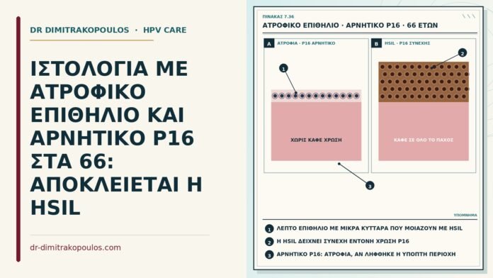 ΙΣΤΟΛΟΓΙΑ ΜΕ ΑΤΡΟΦΙΚΟ ΕΠΙΘΗΛΙΟ ΚΑΙ ΑΡΝΗΤΙΚΟ P16 ΣΤΑ 66: ΑΠΟΚΛΕΙΕΤΑΙ Η HSIL ατροφικό επιθήλιο με αρνητικό p16