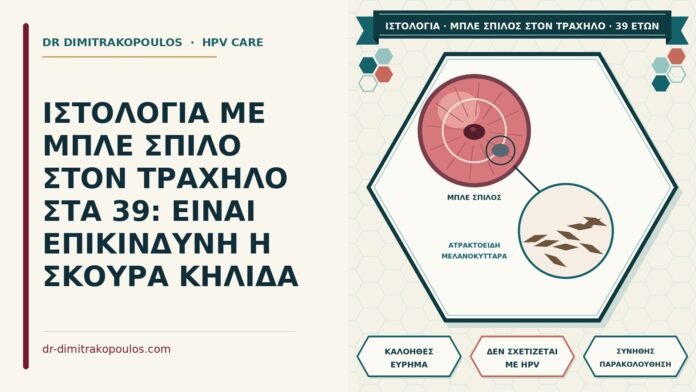 ΙΣΤΟΛΟΓΙΑ ΜΕ ΜΠΛΕ ΣΠΙΛΟ ΣΤΟΝ ΤΡΑΧΗΛΟ ΣΤΑ 39: ΕΙΝΑΙ ΕΠΙΚΙΝΔΥΝΗ Η ΣΚΟΥΡΑ ΚΗΛΙΔΑ μπλε σπίλος τραχήλου